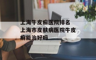 上海牛皮癣医院排名 上海市皮肤病医院牛皮癣能治好吗